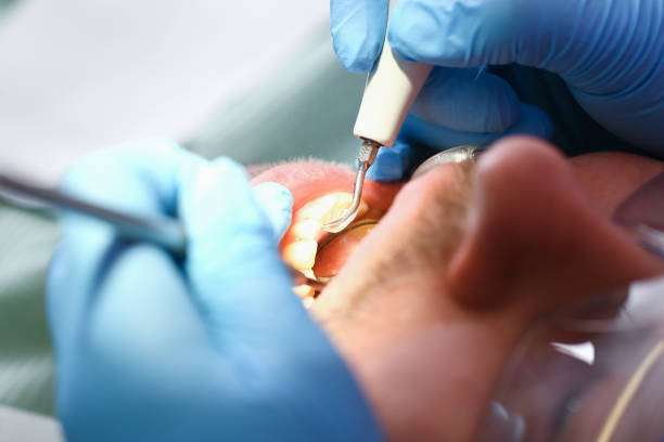 Best Cosmetic Emergency Dentistry in Lake Wylie, SC